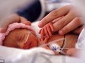Telaten Memantau Bayi Prematur (Bagian 2 - Habis)