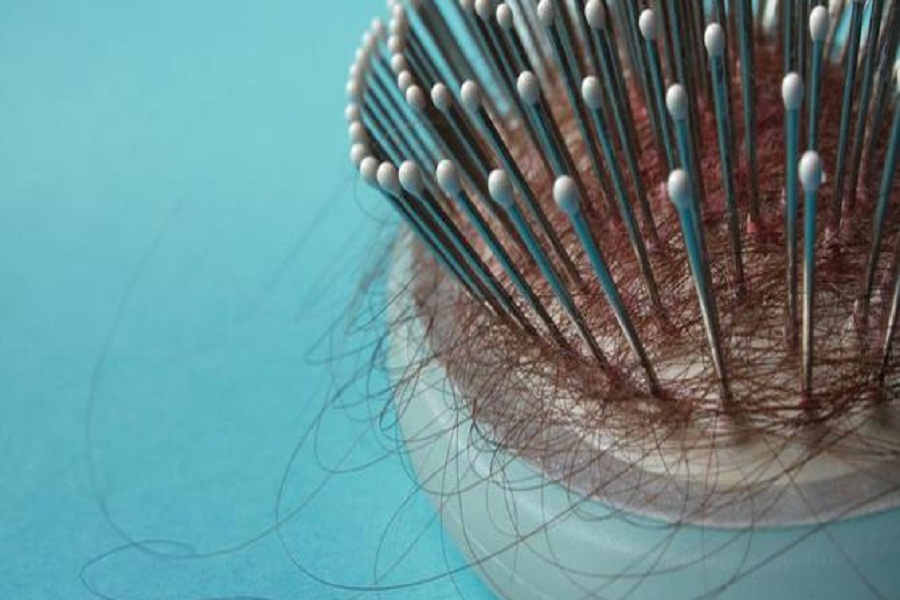 3 Ramuan Warisan Nenek Moyang Ini Ampuh Atasi Rambut Rontok